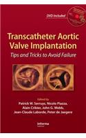Transcatheter Aortic Valve Implantation