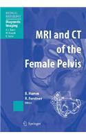 MRI and CT of the Female Pelvis