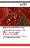 linfocitosis clonal LGL CD4+