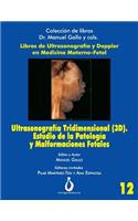 Ultrasonografía Tridimensional (3D). Estudio de la Patología y Malformaciones Fetales