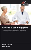 Arterite a cellule giganti