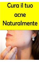 Cura il tuo acne Naturalmente