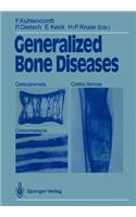 Generalized Bone Diseases
