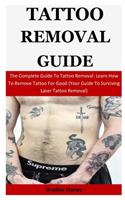 Tattoo Removal Guide: The Complete Guide To Tattoo Removal: Learn How To Remove Tattoo For Good (Your Guide To Surviving Laser Tattoo Removal)