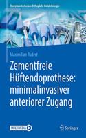 Zementfreie Hüftendoprothese: Minimalinvasiver Anteriorer Zugang