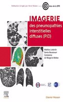 Imagerie Des Pneumopathies Interstitielles Diffuses (Pid)