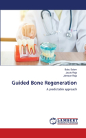 Guided Bone Regeneration