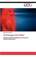 Tetralogia de Fallot