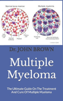 Multiple Myeloma: The Ultimate Guide On The Treatment And Cure Of Multiple Myeloma