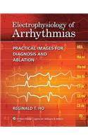 Electrophysiology of Arrhythmias: Practical Images for Diagnosis and Ablation