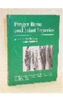 Finger Bone and Joint Injuries
