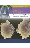 Skin Cancer