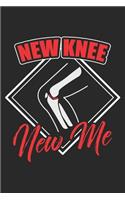 New Knee new me