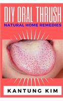 DIY Oral Thrush Natural Home Remedies