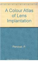 A Colour Atlas of Lens Implantation