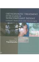 Orthodontic Treatment of the Class II Noncompliant Patient: Current Principles and Techniques