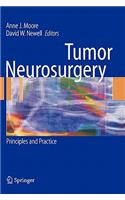 Tumor Neurosurgery