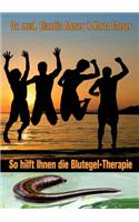 So hilft ihnen die Blutegeltherapie