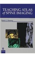 Teaching Atlas of Spine Imaging: (Teaching Atlas S.)