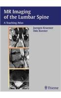 Mr-Imaging of the Lumbar Spine