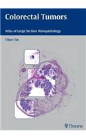 Histopathology of Colorectal Tumors