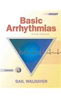 Basic Arrhythmias