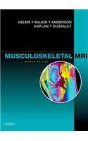 Musculoskeletal MRI E-Book