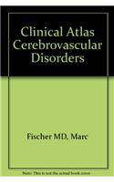 Cerebrovascular Disorders