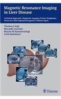 Magnetic Resonance Imaging in Liver Disease: Technical Approach, Diagnostic Imaging of Liver Neoplasms, Focus on a New Superparamagnetic Contrast Agent