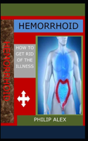 Hemorrhoid: How to Get Rid of the Illness