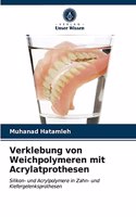 Verklebung von Weichpolymeren mit Acrylatprothesen