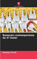 Remoção contemporânea do 3° molar