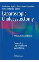 Laparoscopic Cholecystectomy