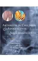 Arthritis in Children and Adolescents