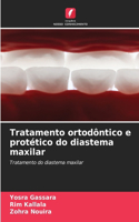 Tratamento ortodôntico e protético do diastema maxilar