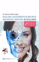 Occlusal Adjustments in Implants and Natural Dentition:3d