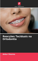 Reacções Teciduais na Ortodontia