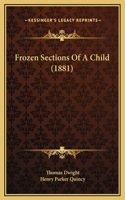 Frozen Sections Of A Child (1881)