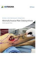 Minimally Invasive Plate Ostheosynthesis