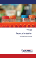 Transplantation