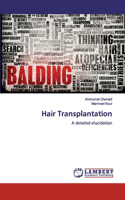 Hair Transplantation