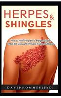 Herpes and Shingles: How to Relief the Pain of Herpes Zoster, Treat the Virus and Prevent Future Outbreak