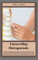 Unraveling Osteoporosis