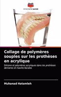 Collage de polymères souples sur les prothèses en acrylique