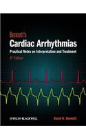 Cardiac Arrhythmias 8e