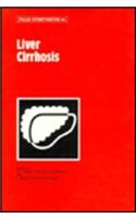 Liver Cirrhosis