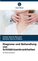 Diagnose und Behandlung von Schilddrüsenkrankheiten