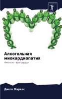 Алкогольная миокардиопатия