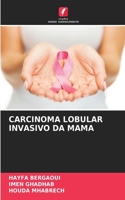 Carcinoma Lobular Invasivo Da Mama