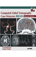 Computed Aided Tomography Case Histories Brain